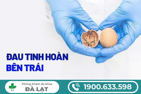 Hình ảnh minh họa